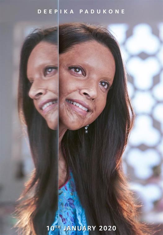 Chhapaak First Look On 'How's The Hype?': BLOCKBUSTER Or Lacklustre?