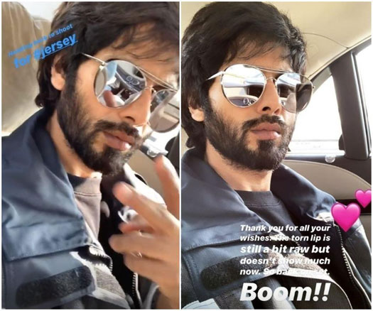 Shahid Kapoor Flies To Chandigarh For Jersey's Shoot Post Lip Injury, Updates That His Wound Is Still Raw