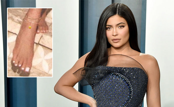 Kylie Jenner On Her Toe Woes: "There's Nothing You Can Do For A Broken Toe"