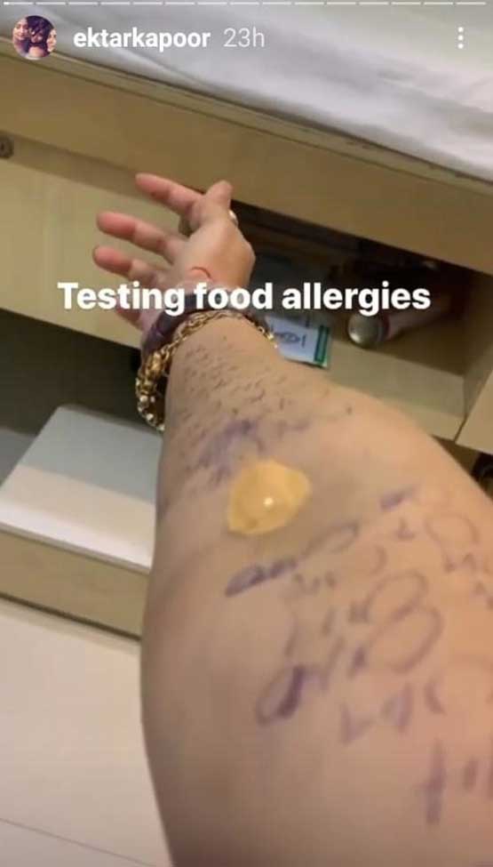 Ekta Kapoor Opens Up About Her Food Allergy & This Popular Vegetable Is What She's Allegic To
