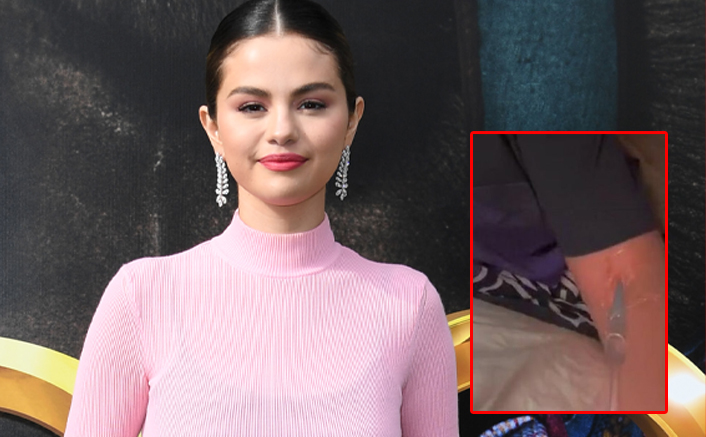 Selena Gomez Fans Spot A Tube In Her Arm During Chat With Timothée Chalamet; Netizens Fear For Her Health