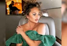 Chrissy Teigen has fat removed from her face
