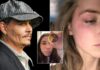 Amber Heard Exposed By TikTok User Who Shows How She Made Up Bruises & Blamed Johnny Depp For It – Watch Viral Video