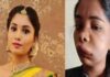 Kannada actress Swathi's face gets horribly swollen after root canal op goes wrong