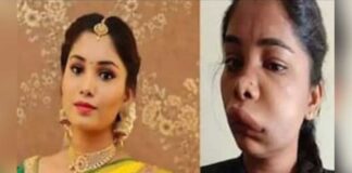 Kannada actress Swathi's face gets horribly swollen after root canal op goes wrong